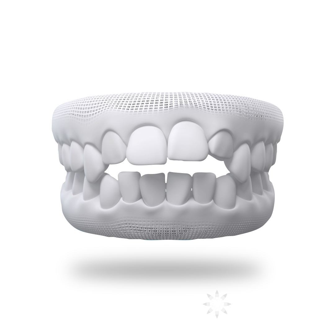 Openbite Teeth